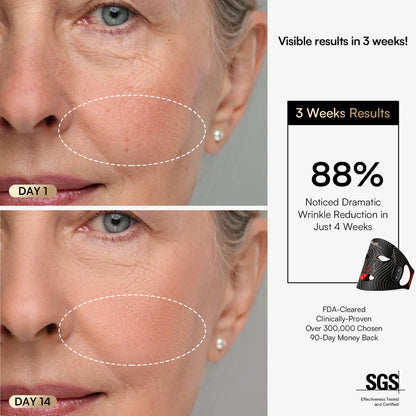 Red Light Therapy Mask