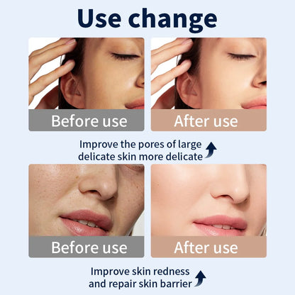 Red Light Therapy Mask